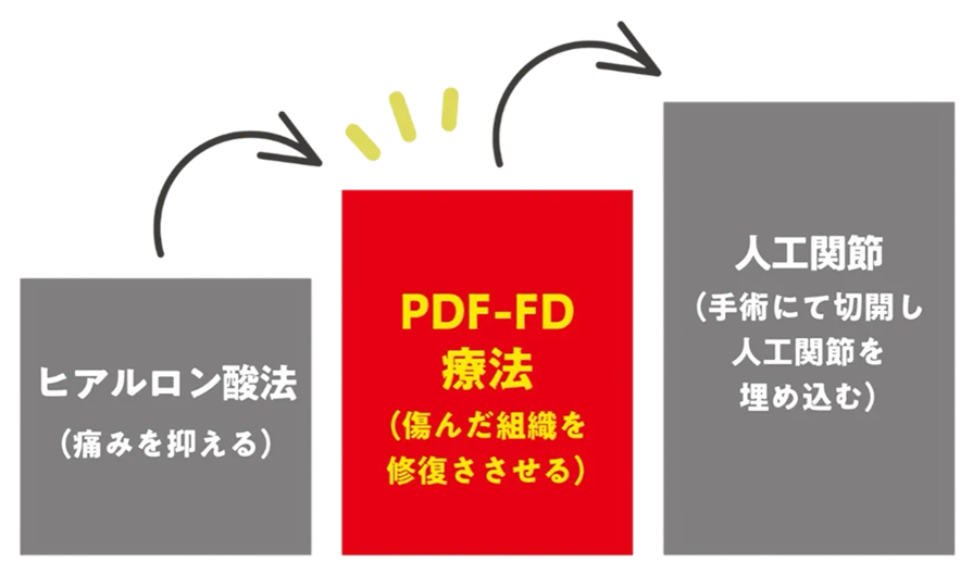 PDF-FD®療法